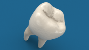 Molar Tooth