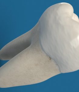 Molar Tooth