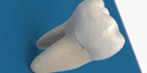 Molar Tooth